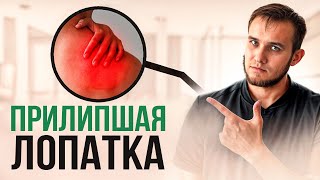 Синдром ПРИЛИПШЕЙ ЛОПАТКИ — главная причина боли в спине и шее! Упражнения для избавления