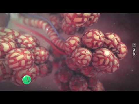 რა იწვევს უსიამოვნო სუნს პირის ღრუდან?