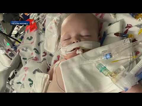 Mom warning parents after infant swallows water bead, now fighting for her life