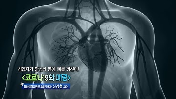 코로나19와 폐렴 - 영남대학교병원 호흡기내과 신경철 교수