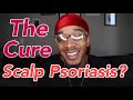 Scalp Psoriasis with Dreadlocks | Finally a Cure? |