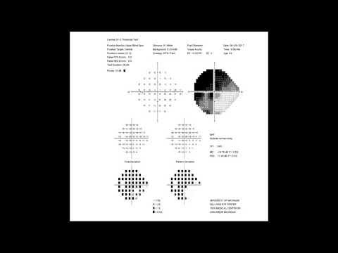 RS Visual Fields Part 2 Interpreting The Test Results