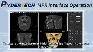 How to Efficiently Use Ryder Medical Software for Bright Moon CT Imaging