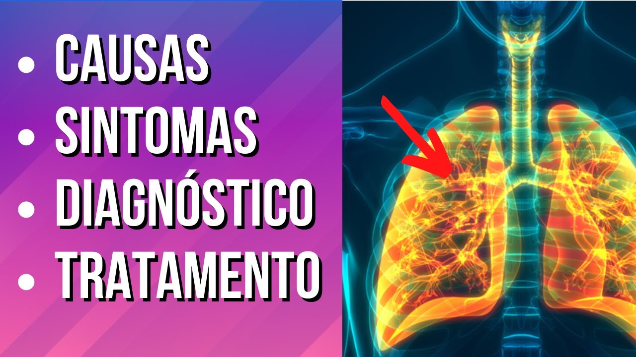 INSUFICIÊNCIA RESPIRATÓRIA Causas, Sintomas e Tratamento YouTube INSUFICIÊNCIA RESPIRATÓRIA Causas, Sintomas e Tratamento YouTube