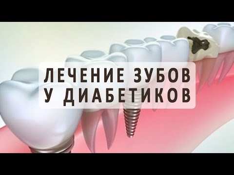 Проблемы с зубами и протезирование зубов при сахарном диабете Проблемы с зубами и протезирование зубов при сахарном диабете