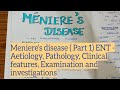 Menieres disease  part 1  ent 