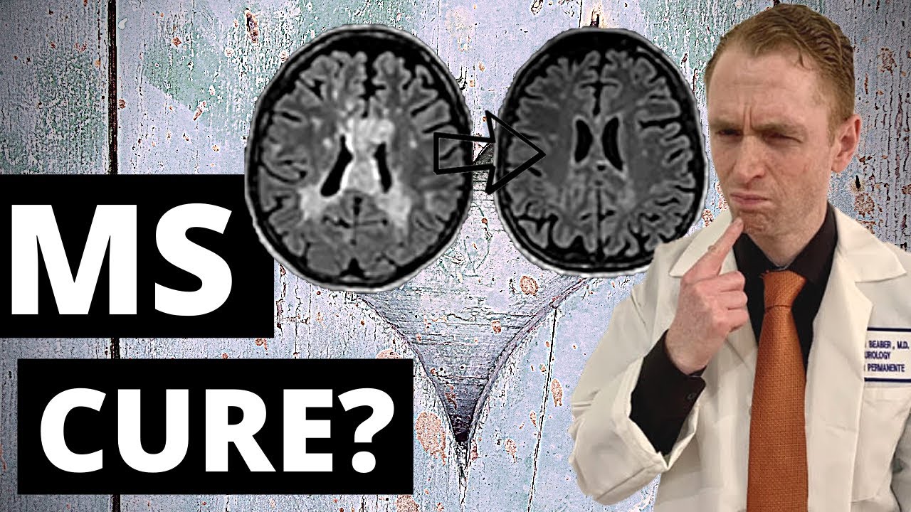 When Will MS Be Cured? YouTube