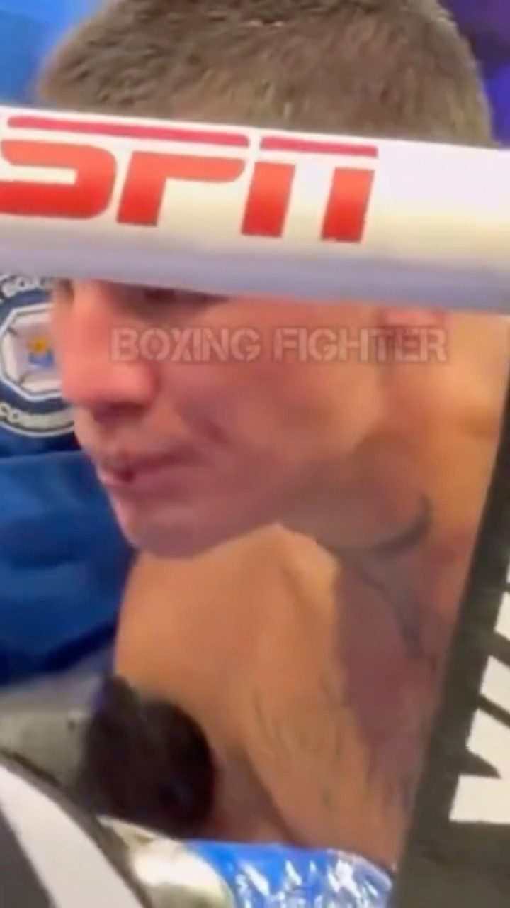 EL DRAMA DE ÓSCAR VALDEZ! ASÍ SE VIO DESDE RINGSIDE MOMENTO EN QUE ASIMILA DOLOR FÍSICO Y EMOCIONAL