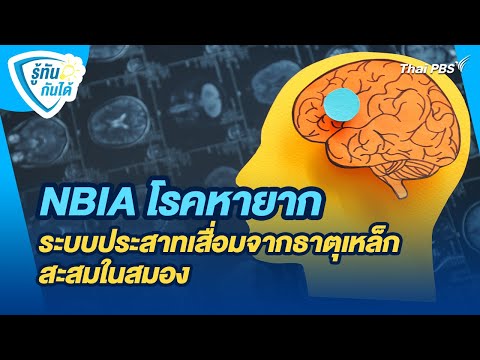 NBIA โรคหายาก ระบบประสาทเสื่อมจากธาตุเหล็กสะสมในสมอง | รู้ทันกันได้