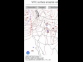 Surface Analysis Loop of 4 Jan 2008 Storm