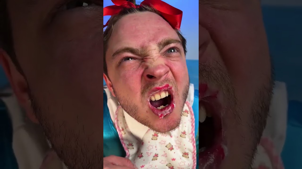 Cola Lip Trick?! 🥤💋 The Weirdest Cure Actually Worked! 