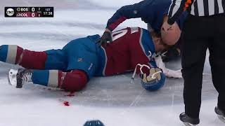 Nathan MacKinnon Left The Game Bloodied After Collision With Taylor Hall