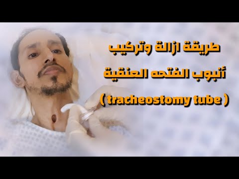 طريقة تركيب انبوب الفتحه العنقية | how to change the tracheostomy tube