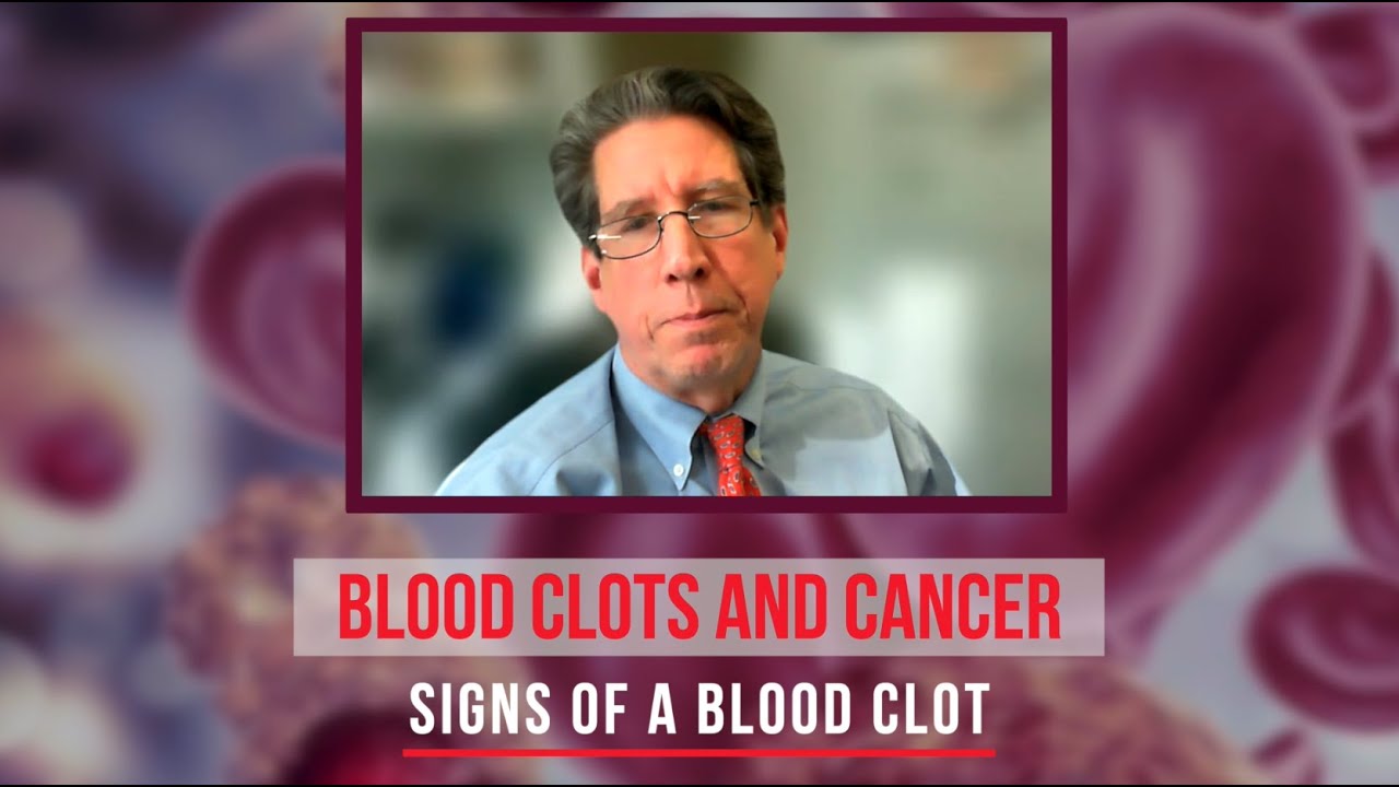 Blood Clots And Cancer Series What Are The Signs Of Thrombosis A Blood blood-clots-and-cancer-series-what-are-the-signs-of-thrombosis-a-blood
