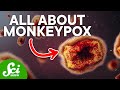 The Truth Behind Monkeypox