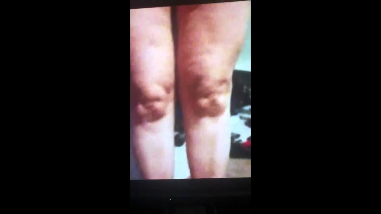 Freaky baby knees YouTube