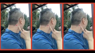 DIY-Migrain 💆‍♂️Pijat Sakit Kepala-Stroke .CLM Tit Tar oleh Master Chris LeongMigraine, Pijat Stroke