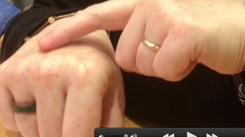 Forensic Anthropology: Veins and Identification