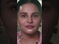 طبيبة تجميل بين المهنة وهوس المثالية