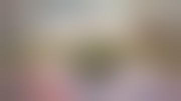 FIBROTIC NON-DILATING PUPIL-NO PUPIL EXPANDER DEVICES USED