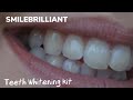 Smilebrilliant teeth whitening kit  honest review chelsea baxter