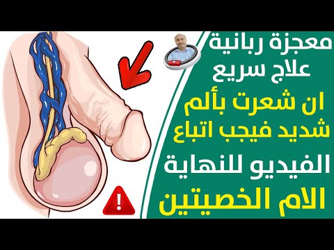 وصفة علاج الم الخصية بدون ادوية  في المنزل- حجم الخصية الكبيرة تسب مشاكل خطيرة |  ما هي دوالي الخصية