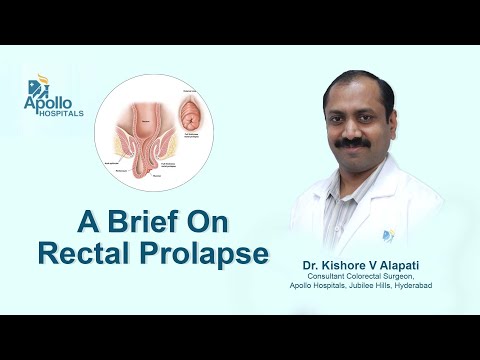Rectal Prolapse | Abnormal Mass from Anus| Dr. Kishore Alapati, Colorectal Surgeon | Apollo Hospital