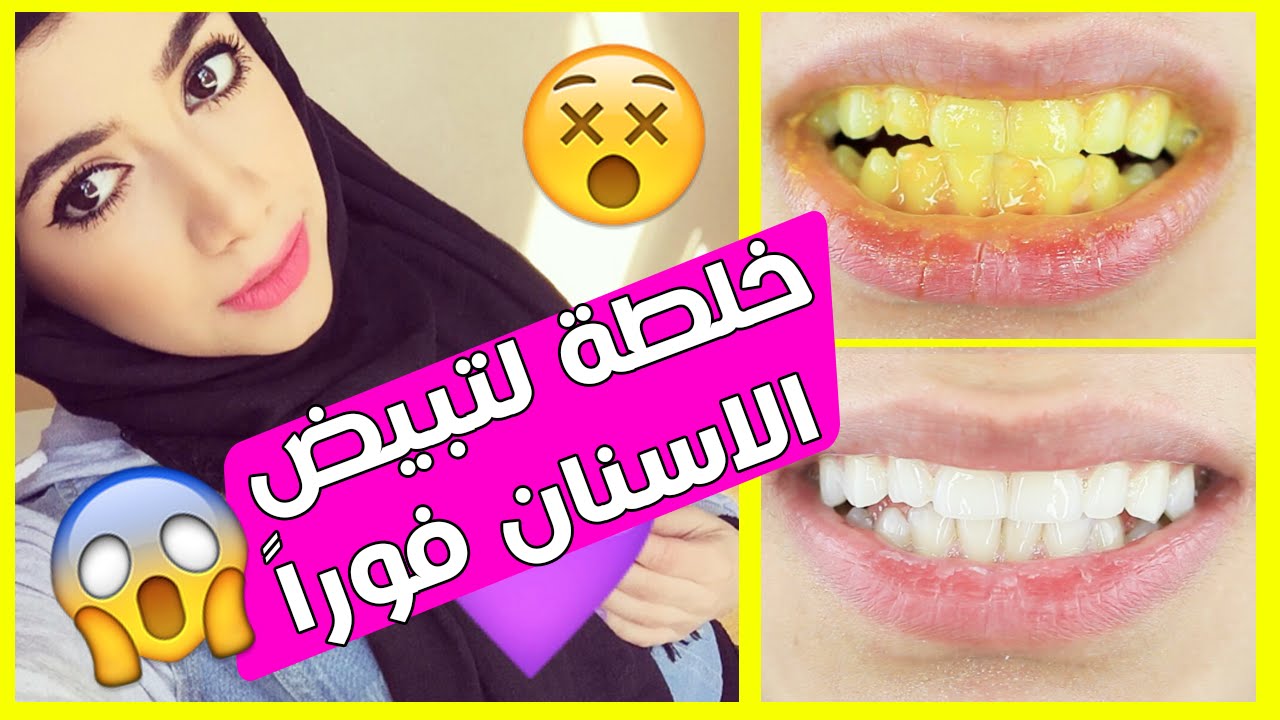 طرق تبيض الاسنان من اول مره