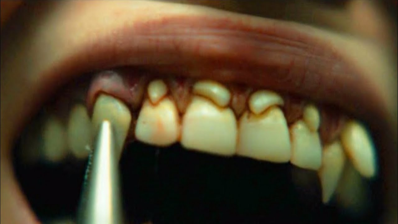 Hybrid explainedsummary in HindiUrduVoice Over YouTube