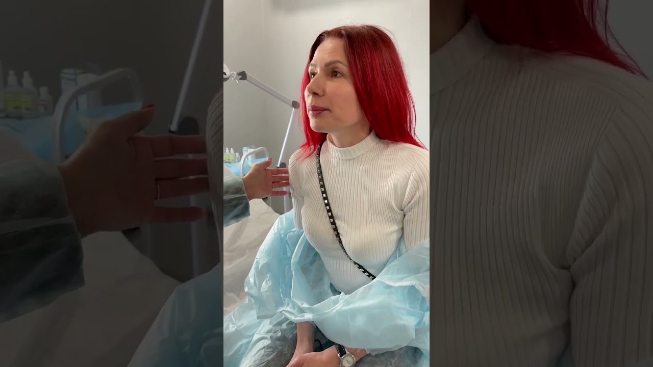 Честный отзыв о нитевом лифтинге