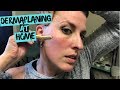 How to Dermaplaning at Home | Shave Your Face and Help Your Skin