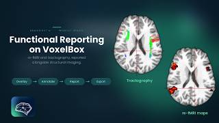 Product Walkthrough: Functional Reporting on VoxelBox