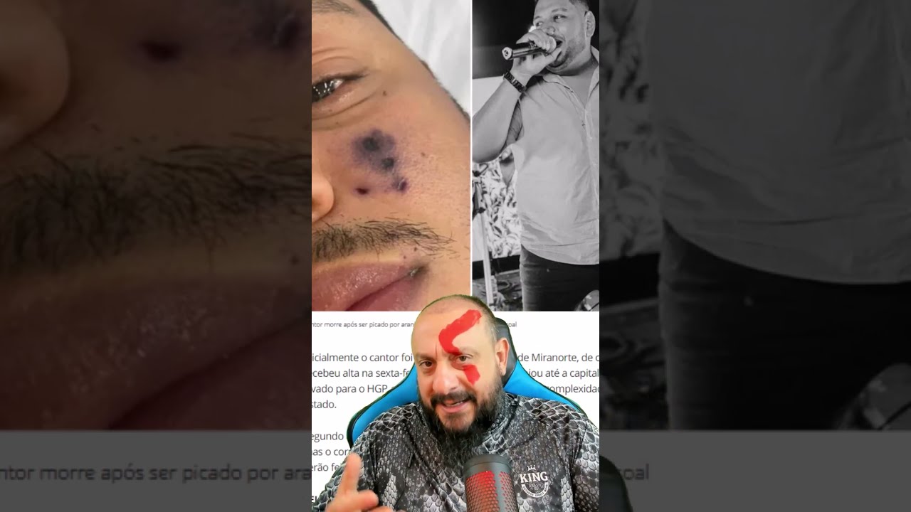 Faleceu Cantor de forró Darlyn Morais após ser picado por aranha e rosto, diz família