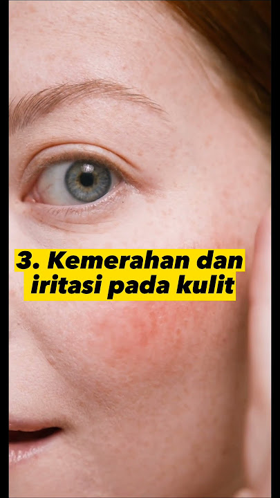 5 tanda WAJAH RUSAK KARENA KRIM BERMERKURI🤨 #videoshort