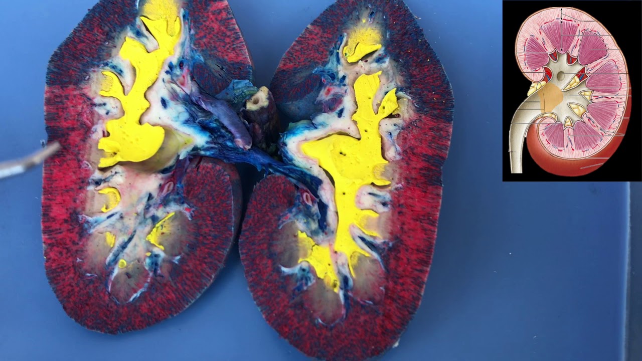 Kidney Dissection YouTube