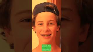 From Childhood to Superstar: A Look at Shawn Mendes' Incredible Journey Through Pictures