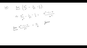 12.7.43 First get a common denominator; then find the limit if it exists: e lim X-0 7-4 Select the …