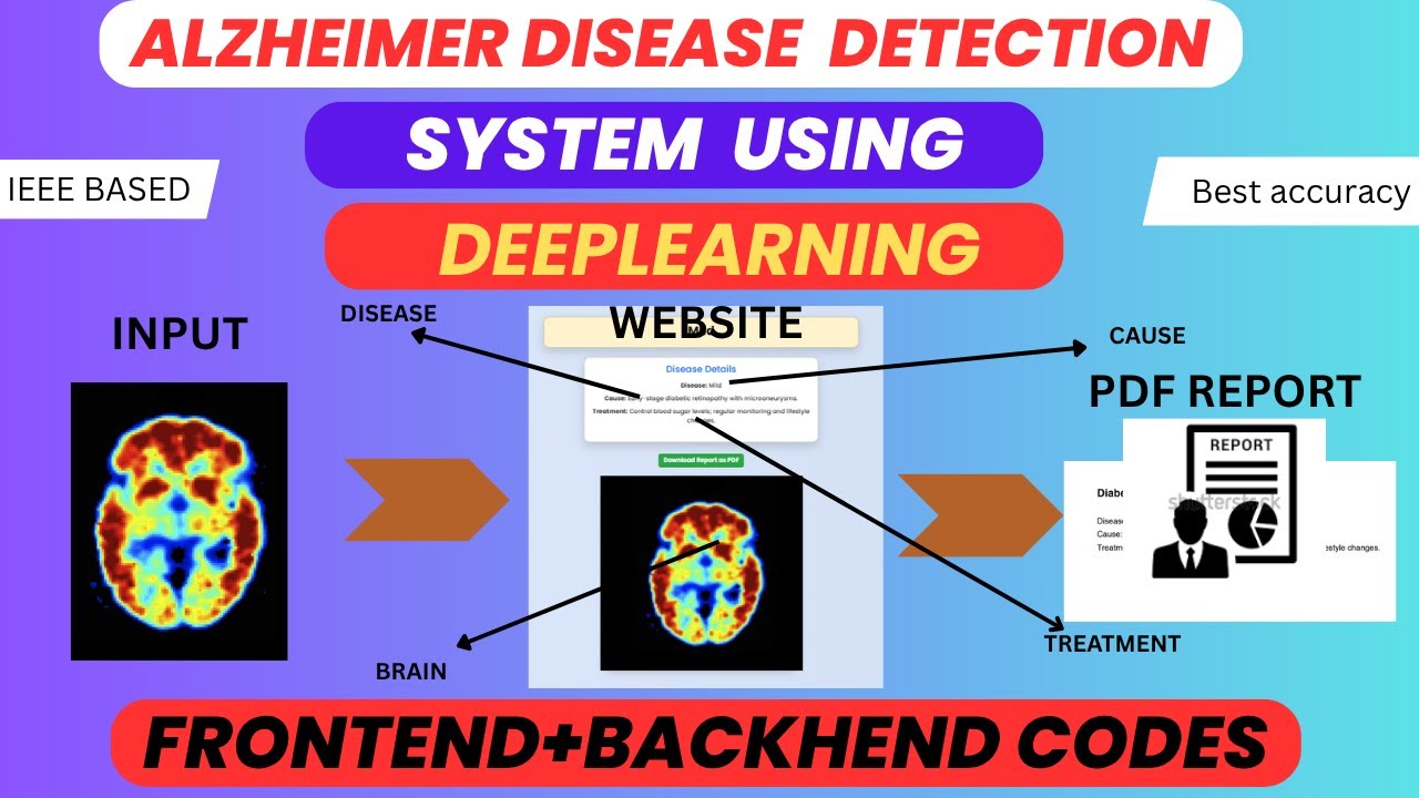 Alzheimer’s Disease Detection Using Deep Learning | IEEE Final Year ...