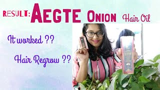 Result : Aegte Onion Hair Oil | Hair REGROW ?? | 100% Honest Video | Madhumita Paul #MadhumitaPaul