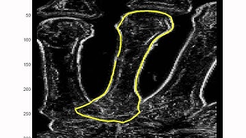 Particle Filter Segmentation