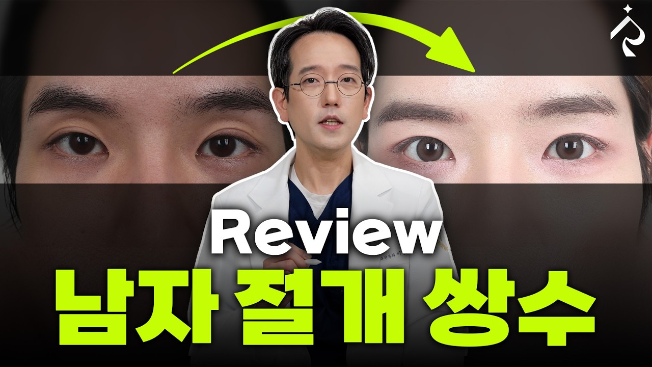 남자 절개쌍수 Reviewㅣ리얼리성형외과
