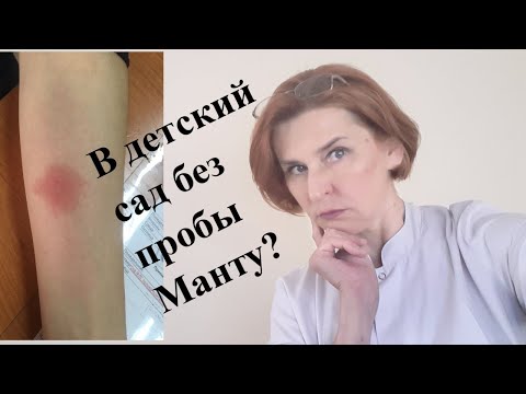 В детский сад без пробы Манту