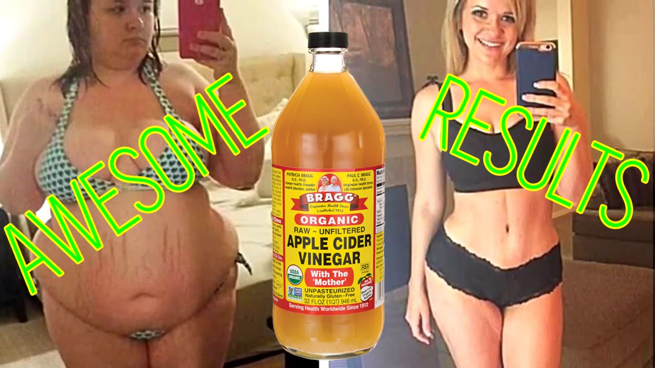 can i use apple cider vinegar for weight loss