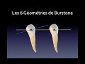 Biomécanique Orthodontique N°2 : Géométries de Burstone