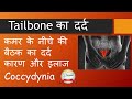 Tailbone का दर्द - कारण और इलाज । कमर के नीचे की बैठक का दर्द  Causes & Treatment : Coccydynia