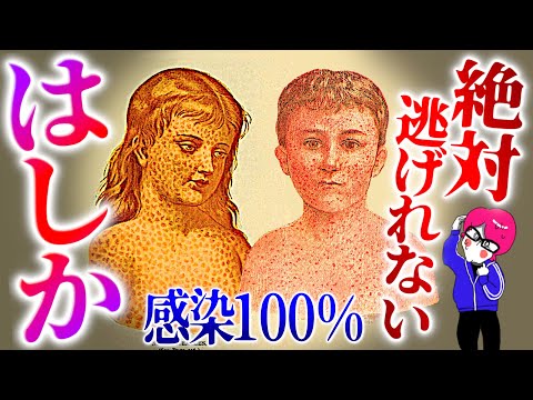 １００％発病！？病のスナイパー【麻疹】脅威の感染症と人類の戦いに目を離す事が出来ない！感染症シリーズ#9