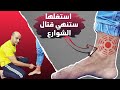 ضربة قوية تشل حركة رجل الخصم خصمك في  القتال الشوارع                    