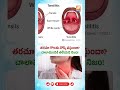 తరచూ గొంతు నొప్పి వస్తుందా..? #viral #shorts #viral #shortsfeed #trendingshorts #trending #fypviral
