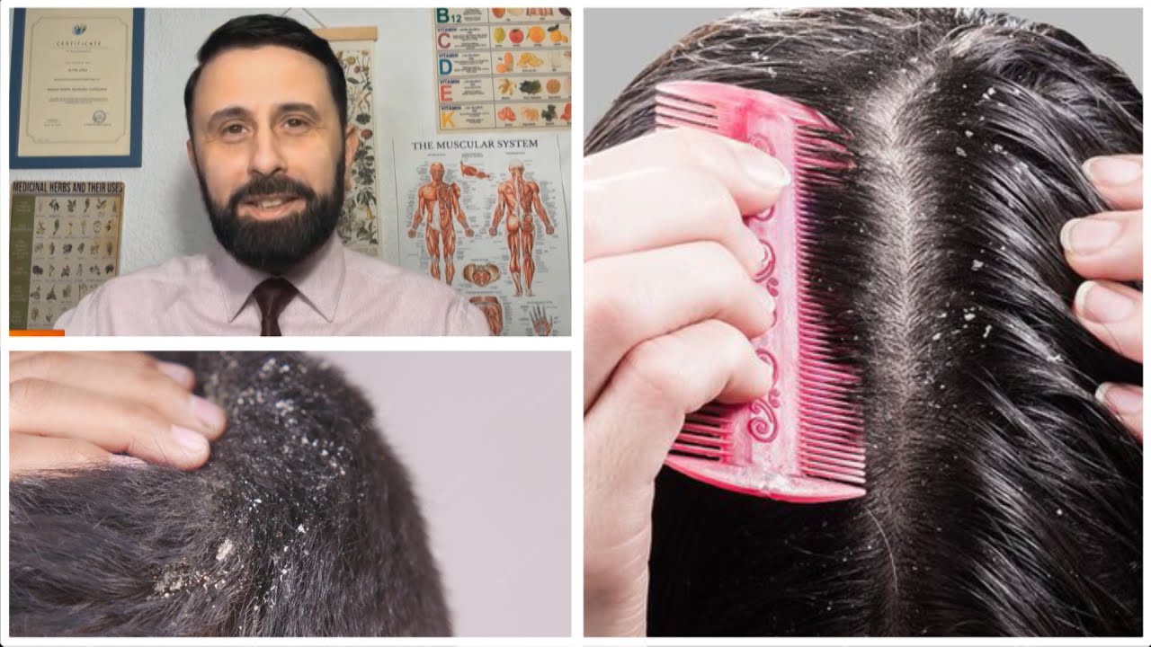 Zbokthi, problem i brendshëm shëndetësor / Ja si ta luftoni