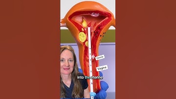 Did you learn something? #iud